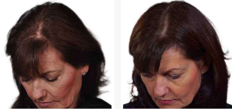 Before and after result