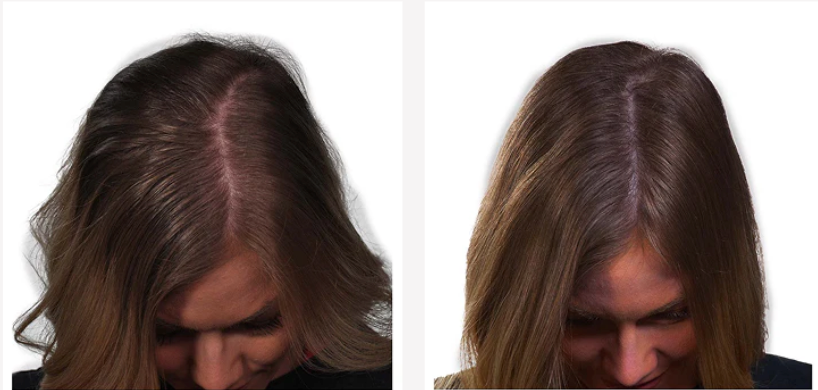 Before and after result