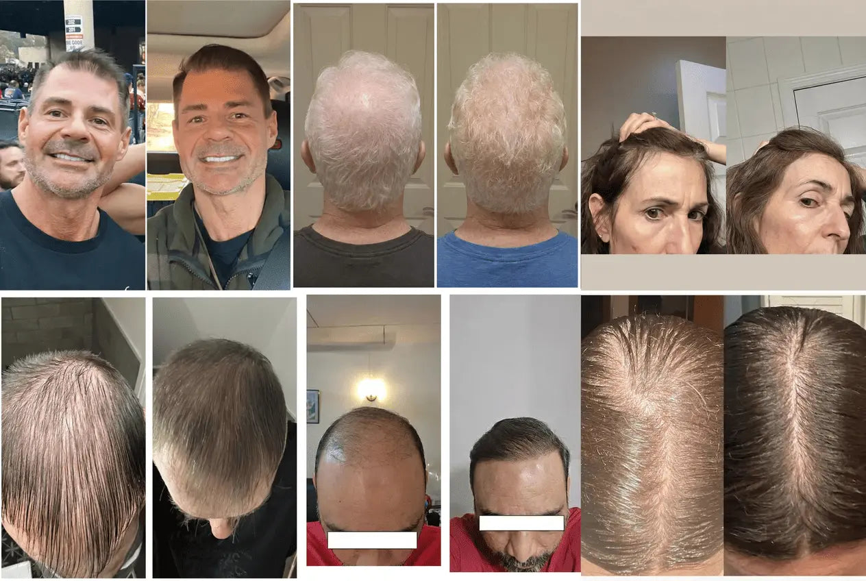 Thinning Hair After 30 Isn't Permanent. It's Just Been Expensive to Fix — Until Now.
