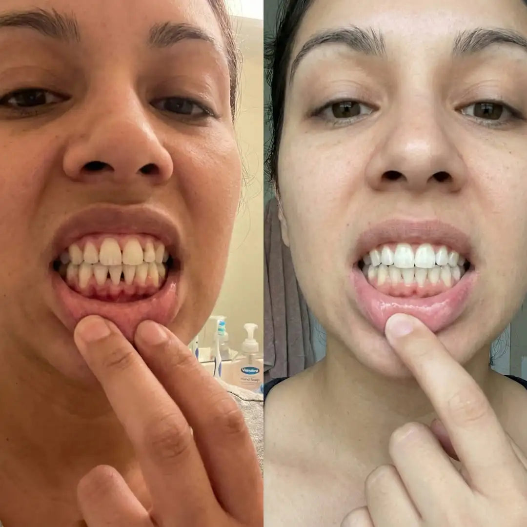 Before and After Results